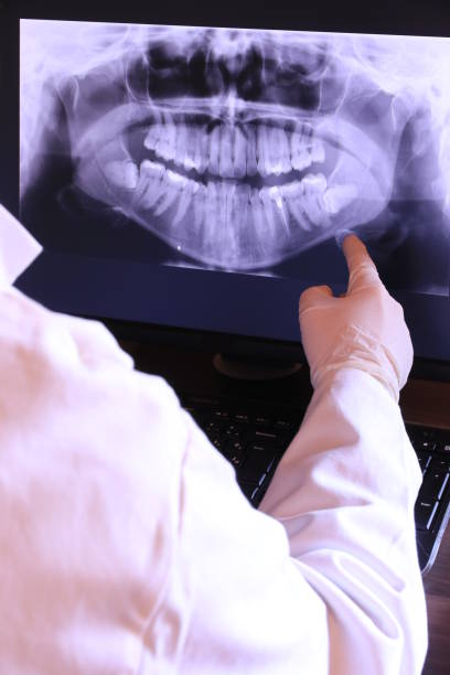 Best Emergency Dentist for Knocked-Out Tooth in Bentleyville, PA